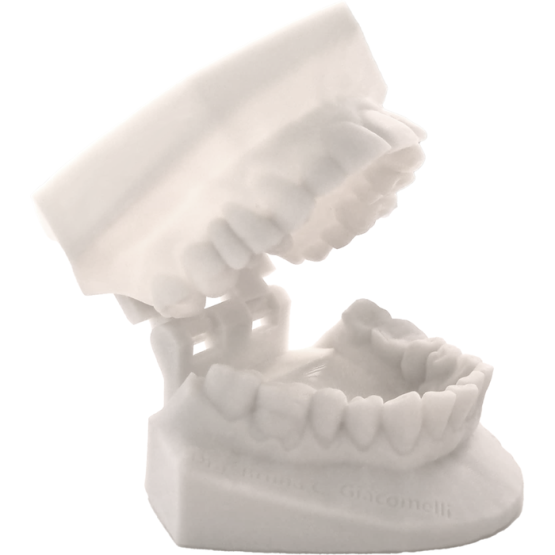 Modelos 3D Ortodônticos Zocalados 