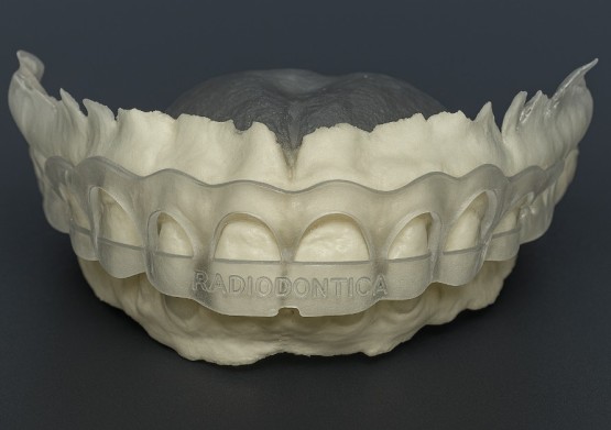 Guia Periodontal (Perioguide)