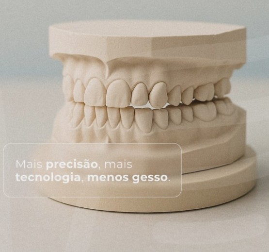 Modelos 3D Ortodônticos Zocalados 